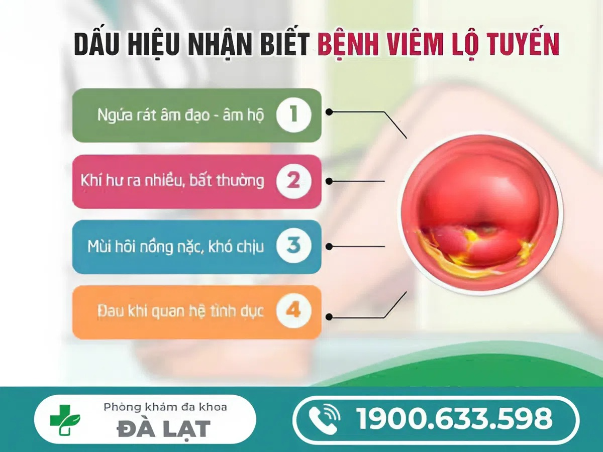 Hình ảnh minh họa